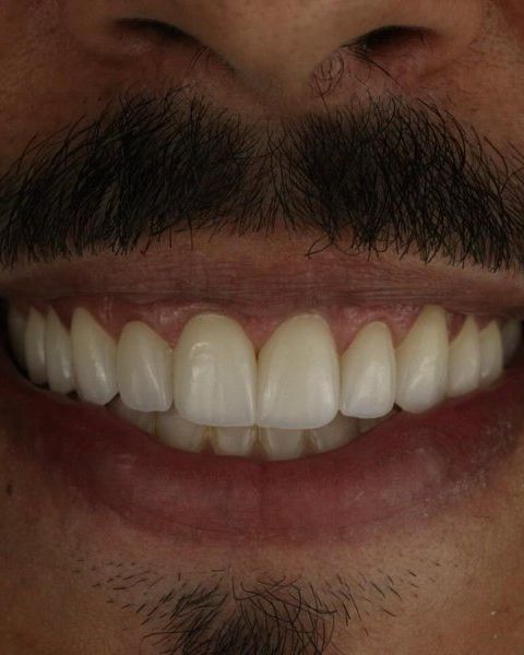 Sorriso masculino visto de perto